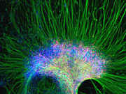 Cluster_of_Neural_Cells_Derived_From_Human_Embryonic_Stem_Cells.jpg