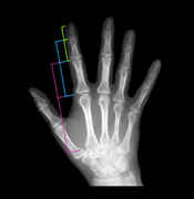 hand-bones-phi-ratio.jpg